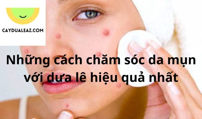 Những cách chăm sóc da mụn với dưa lê hiệu quả nhất